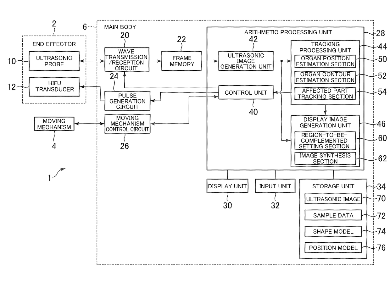 In vivo movement tracking apparatus