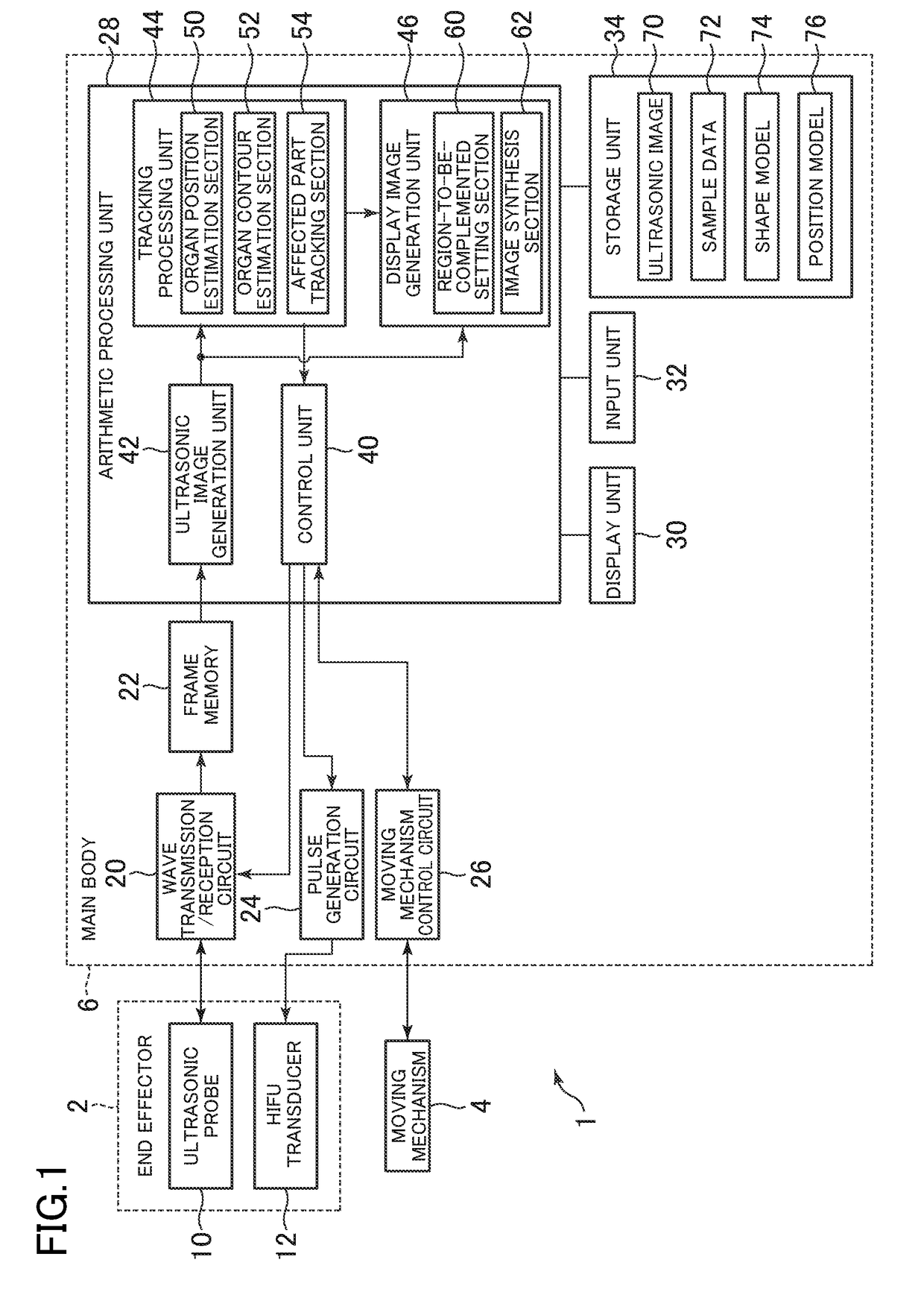 In vivo movement tracking apparatus