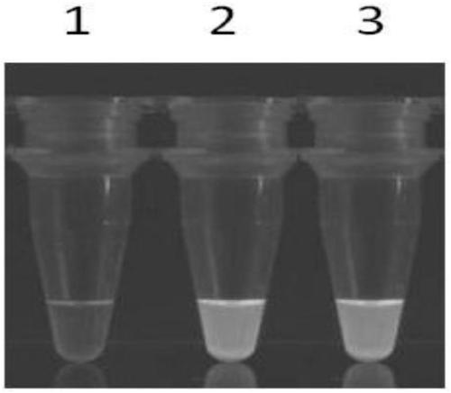 Visual rapid detection kit for enterocytozoon hepatopenaei (EHP)