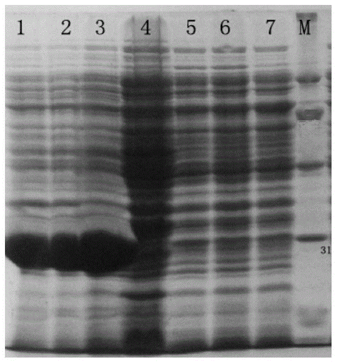 Brucella omp31 antigenic epitope and monoclonal antibody thereof, and application of brucella omp31 antigenic epitope and monoclonal antibody thereof