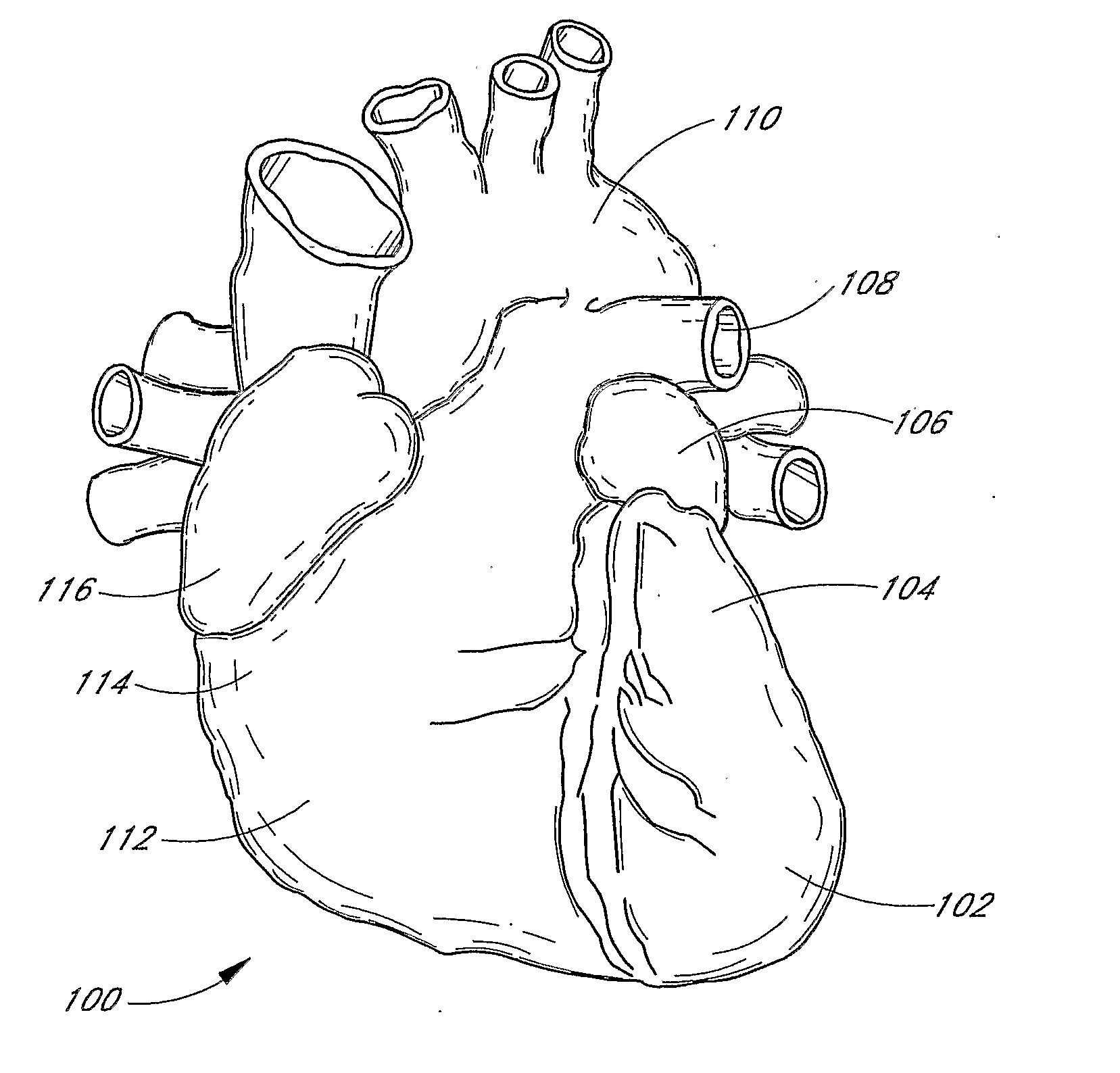 Diode-pumped microlasers including resonator microchips and methods for producing the same