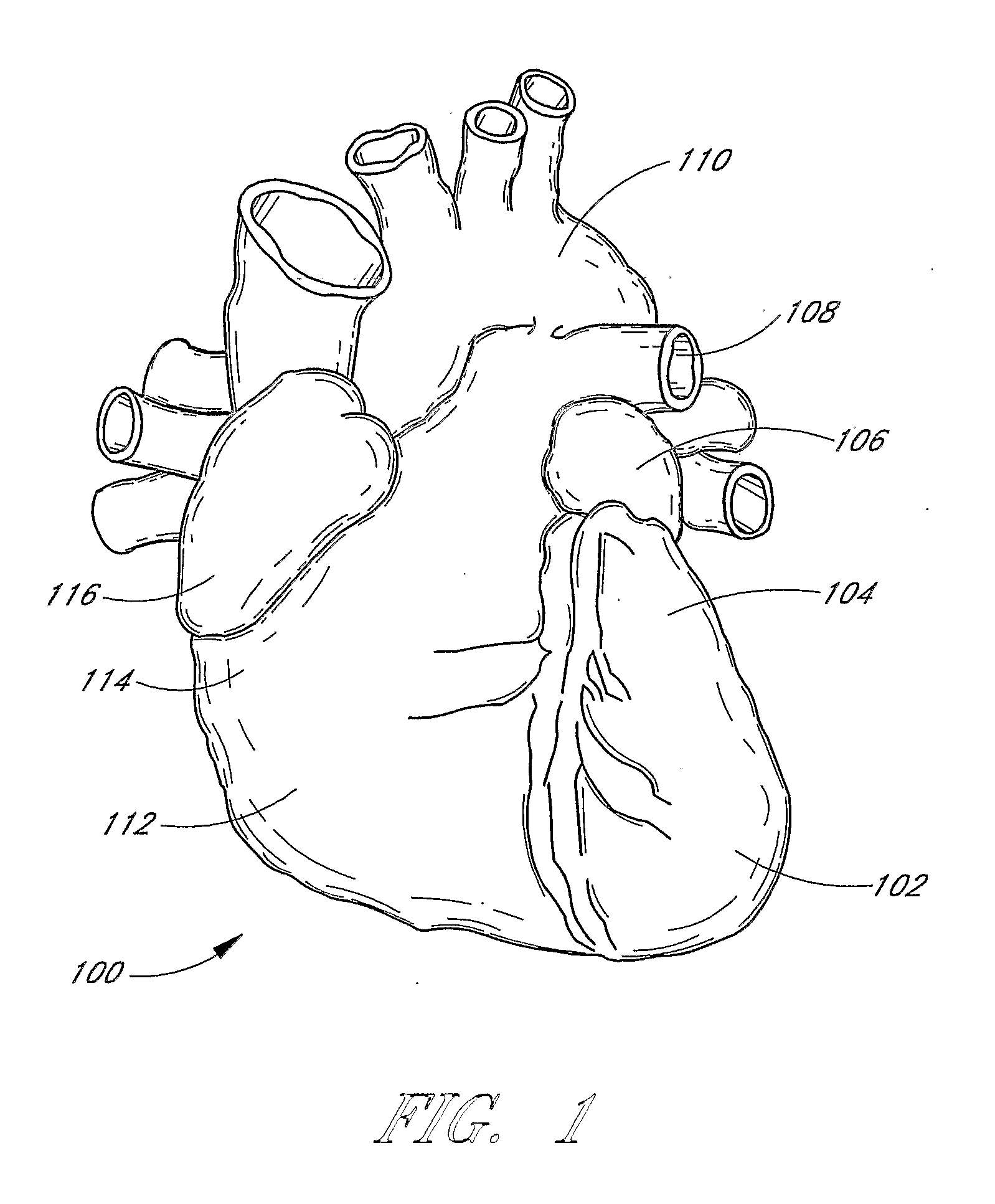 Diode-pumped microlasers including resonator microchips and methods for producing the same