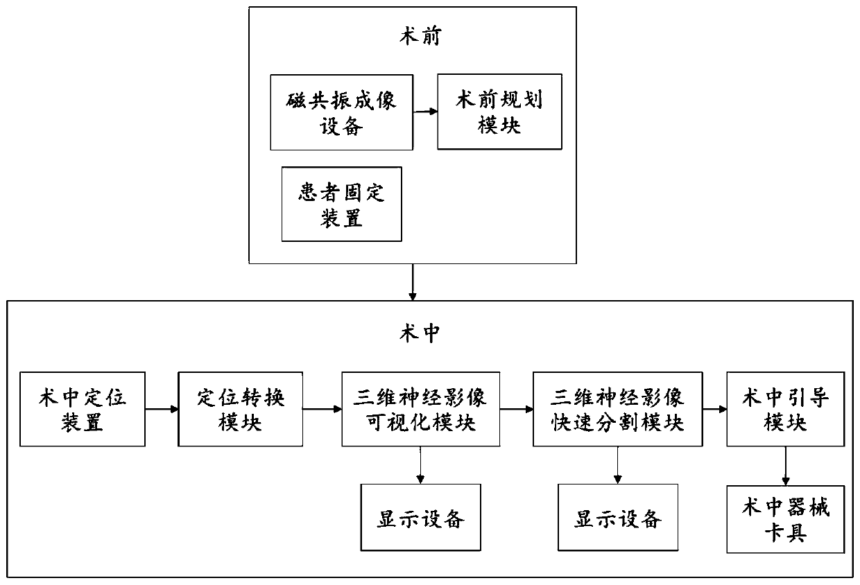 Intracranial operation navigation system based on magnetic resonance imaging