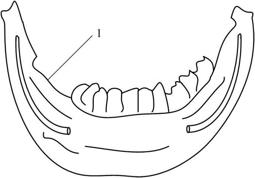 Oral cavity dental implant reconstructable guide plate and manufacturing method thereof