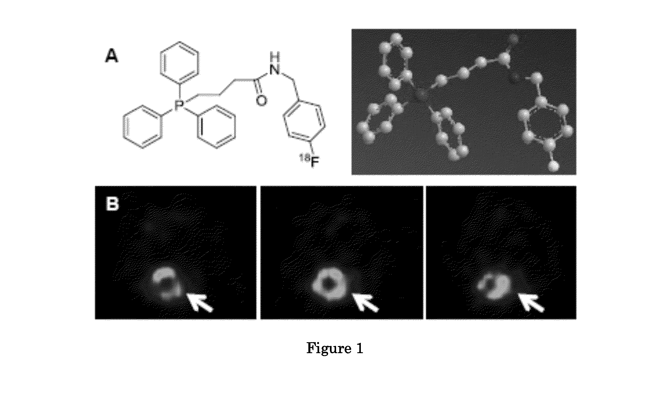 Methods and compositions for positron emission tomography myocardial perfusion imaging