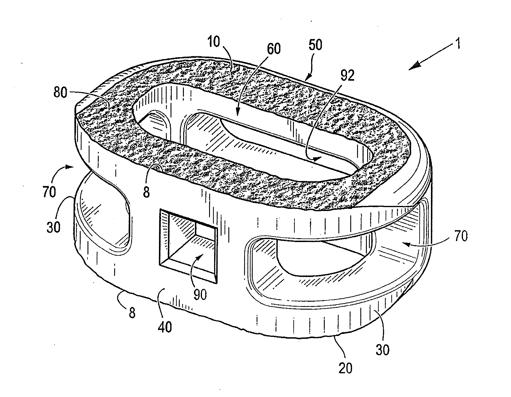 Friction-fit spinal endplate and endplate-preserving method