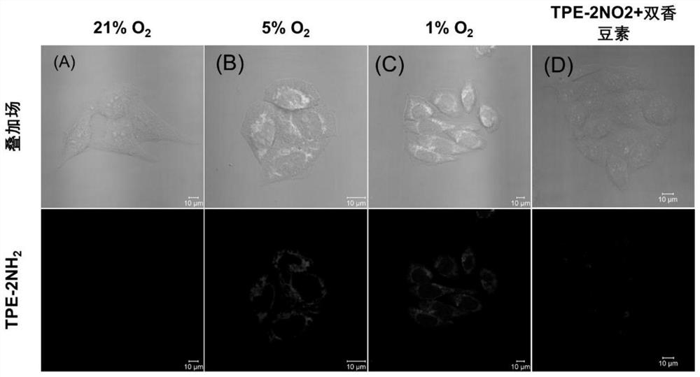 Intracellular polymerization method for hypoxia response type alkyne-amine click polymerization and application of intracellular polymerization method