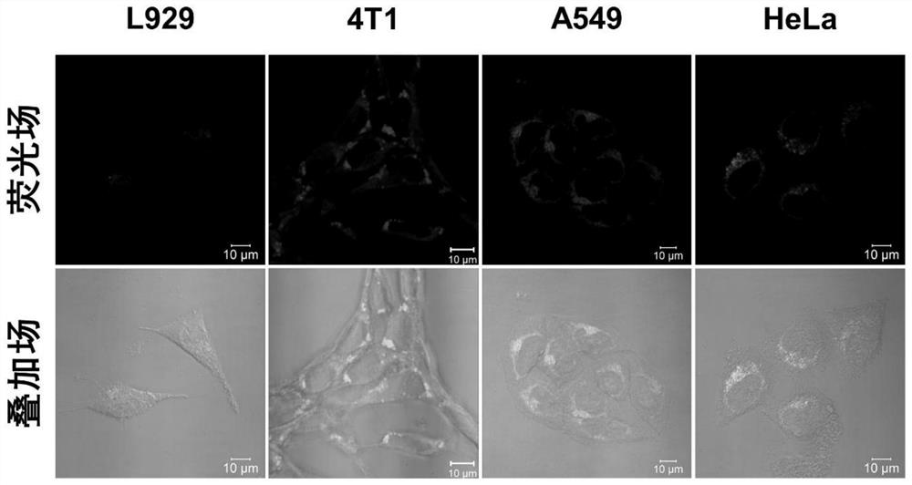 Intracellular polymerization method for hypoxia response type alkyne-amine click polymerization and application of intracellular polymerization method