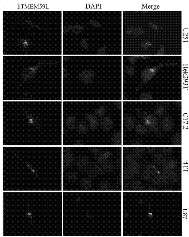 Specific interaction of dentritic cell factor 1 (DCF1) genes and transmembrane protein 59 like (TMEM 59 L) genes