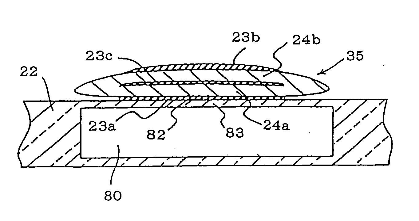 Piezoelectric/electrostrictive film type device and method of manufacturing the same