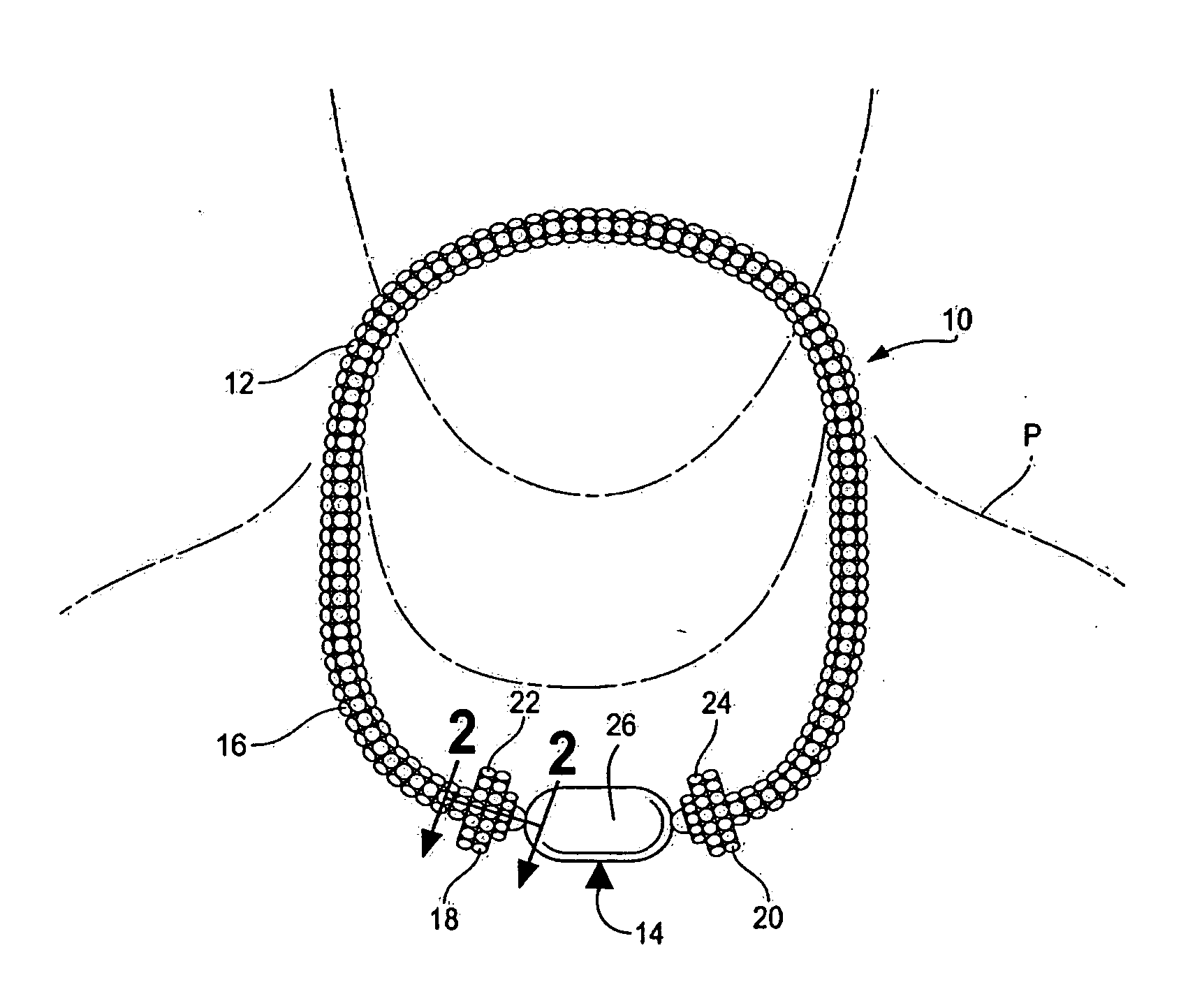 Jewelry assembly