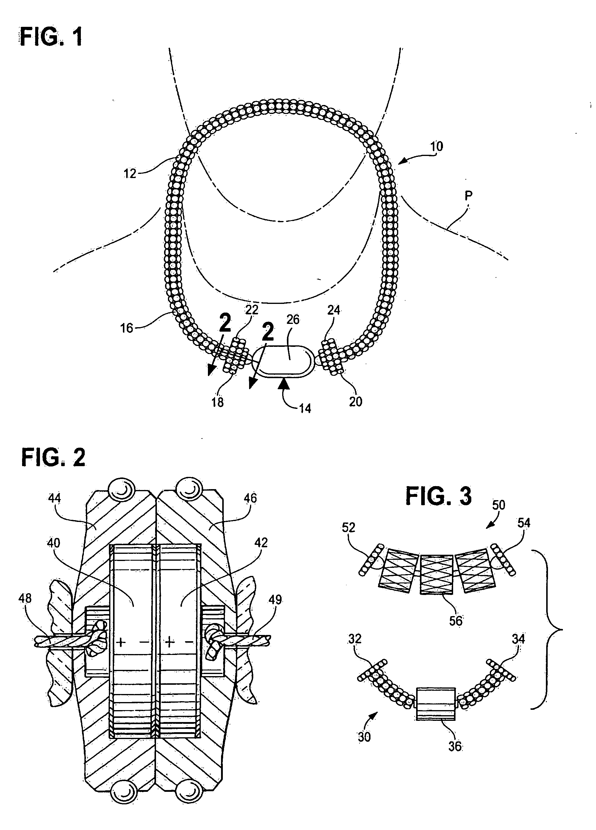 Jewelry assembly