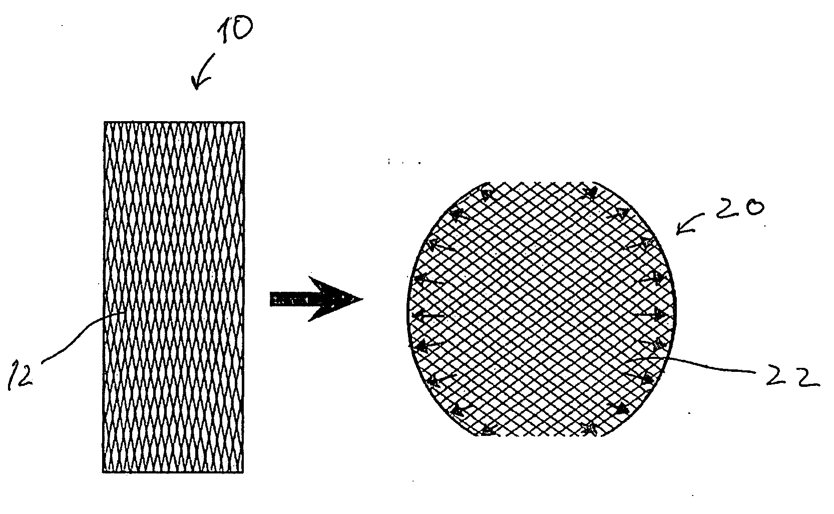 Structurally reinforced spinal nucleus implants