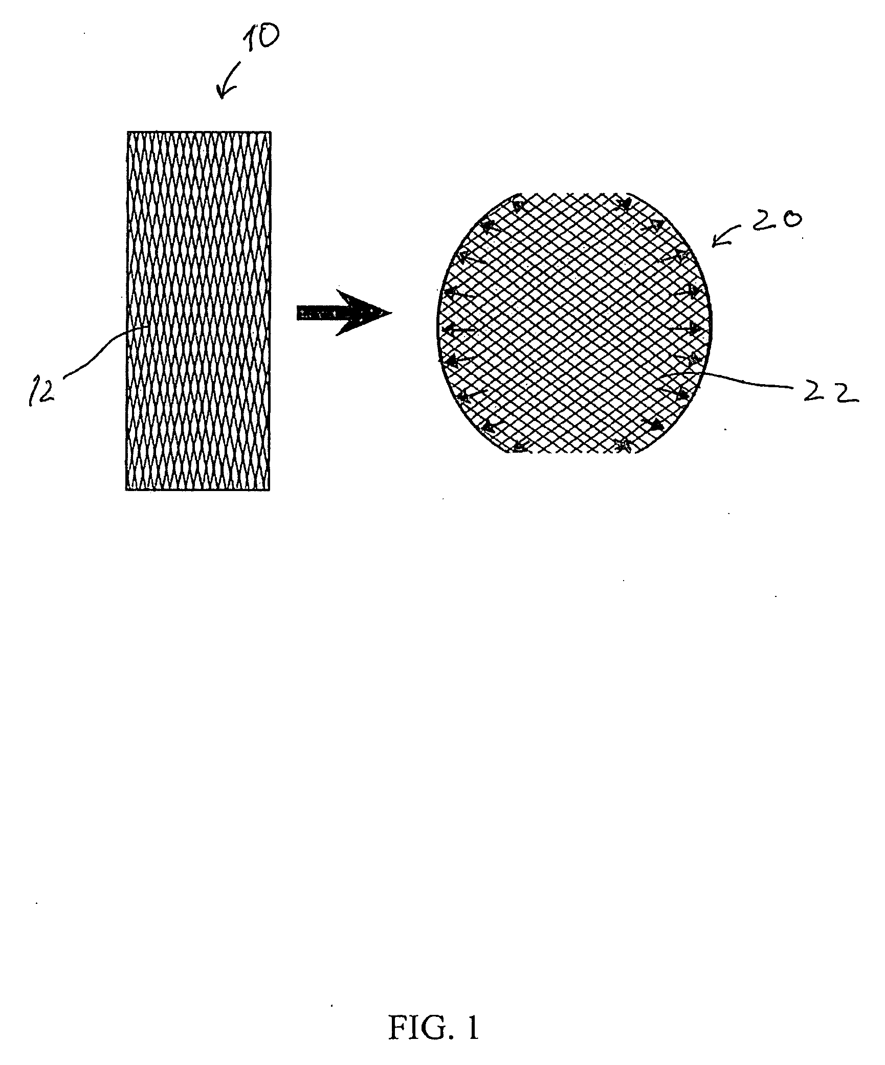 Structurally reinforced spinal nucleus implants