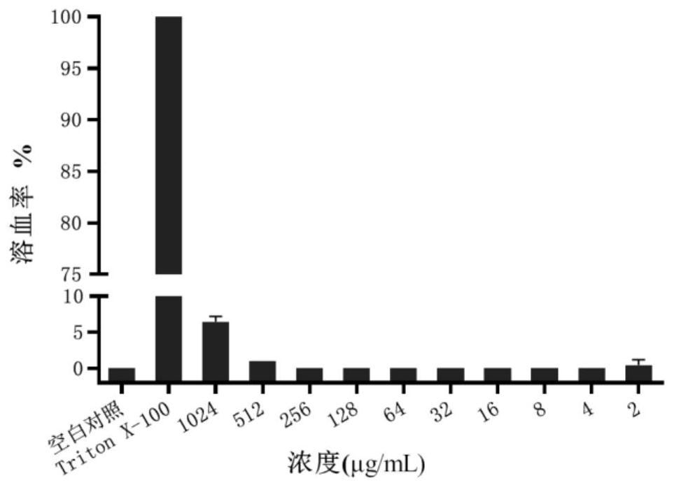 Metal beta-lactamase inhibitor pyridine dicarboxylic acid amine derivative and preparation method thereof