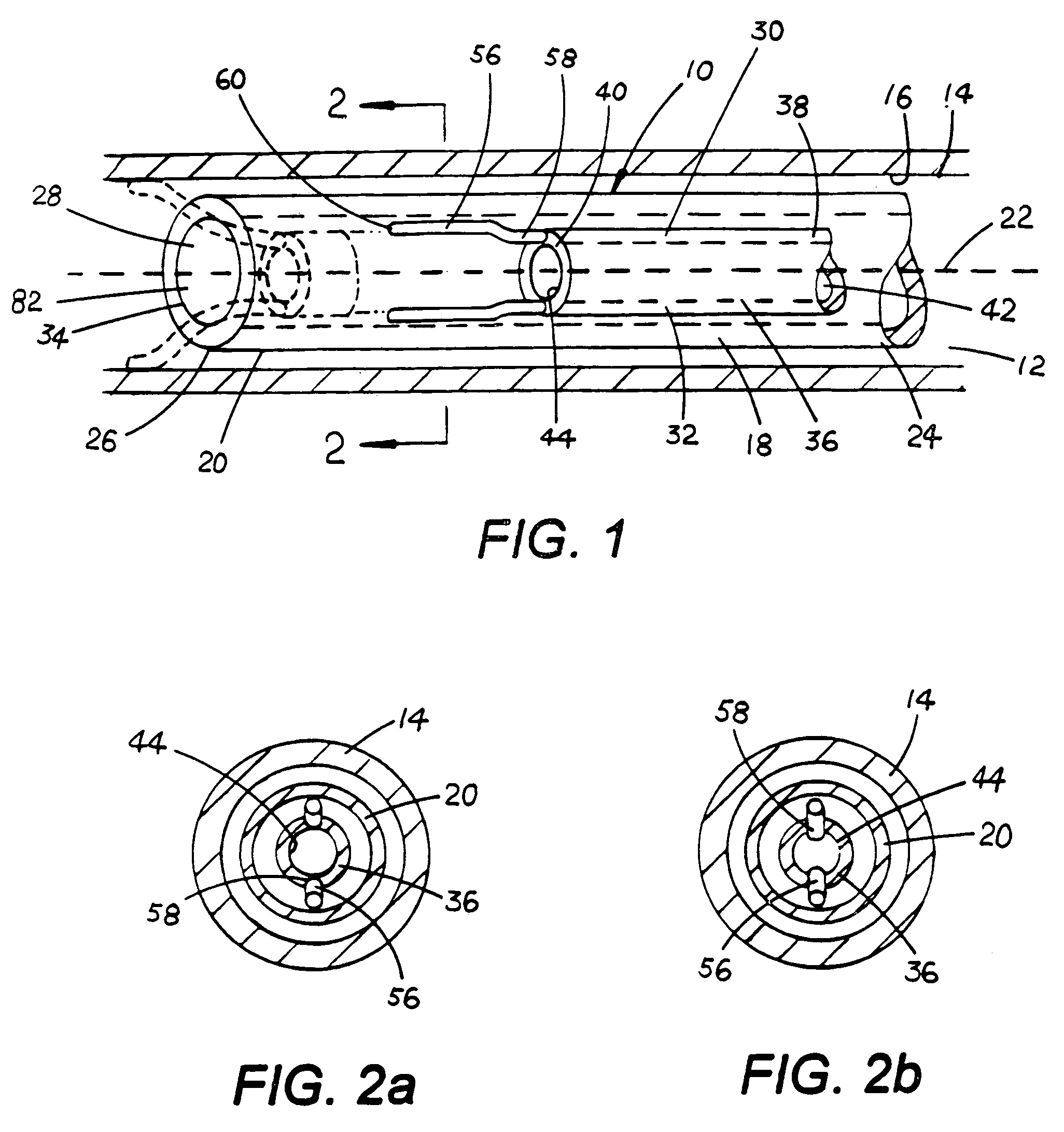 Device for anchoring tubular element