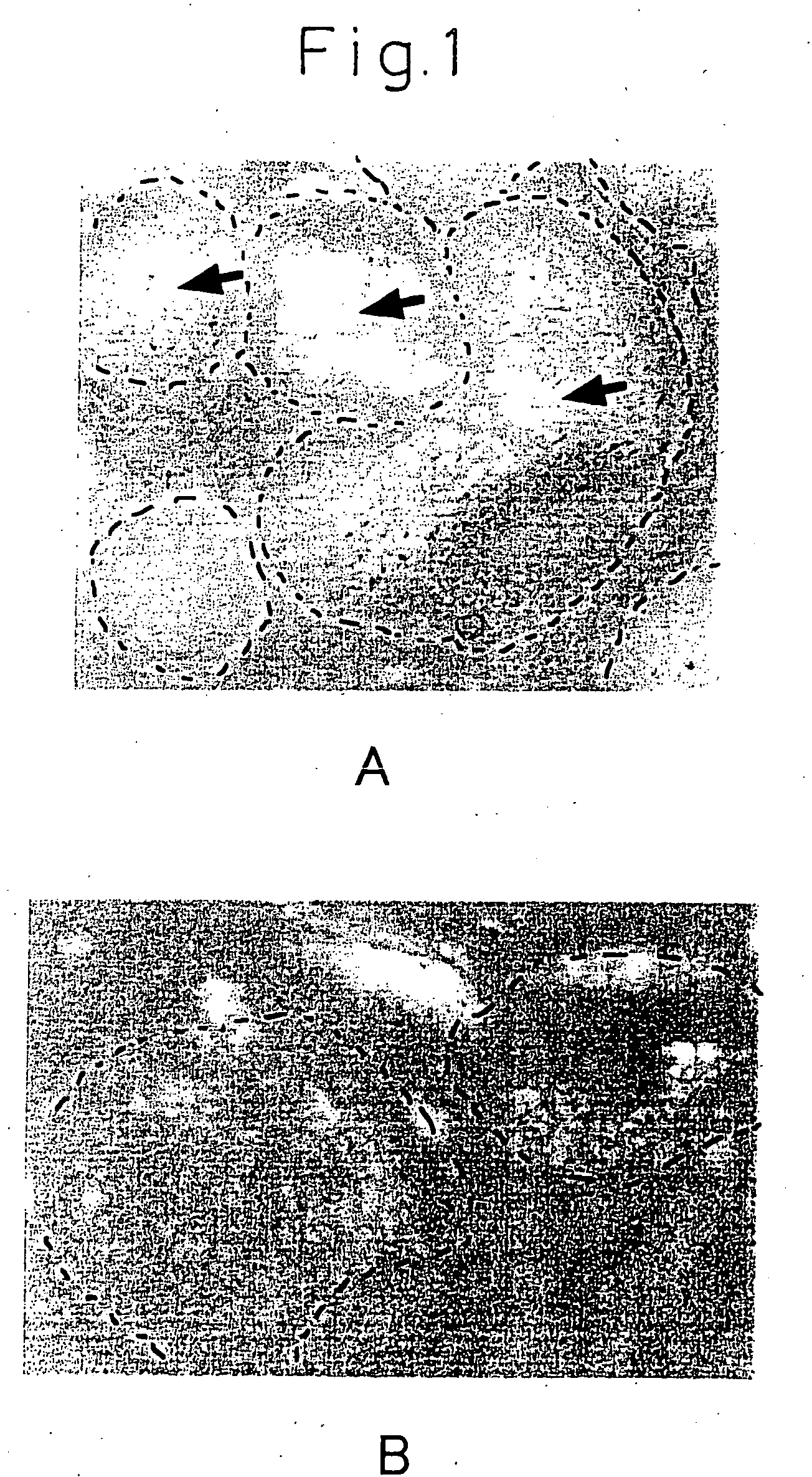 External skin preparations for suppressing sebum secretion