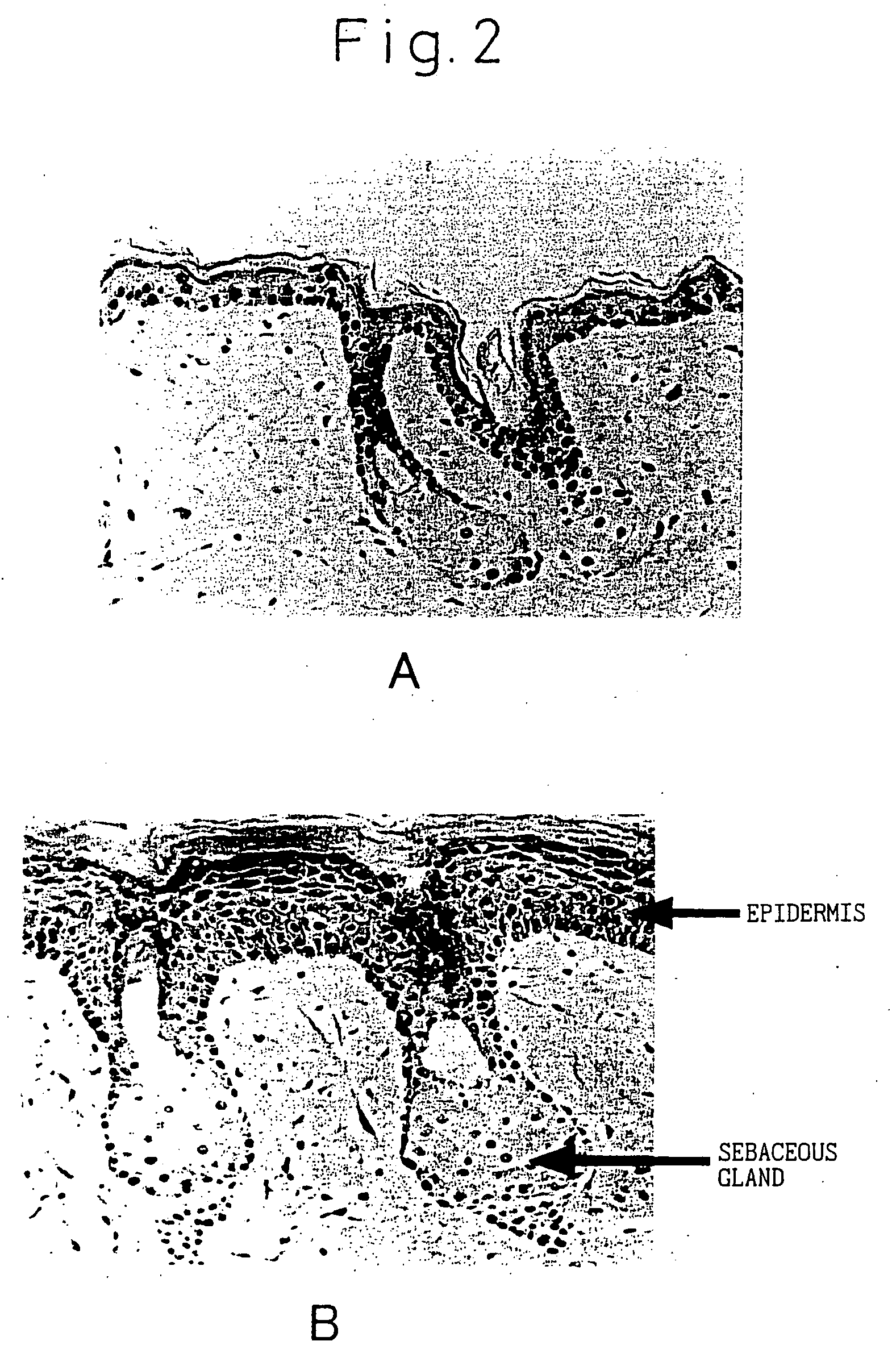 External skin preparations for suppressing sebum secretion