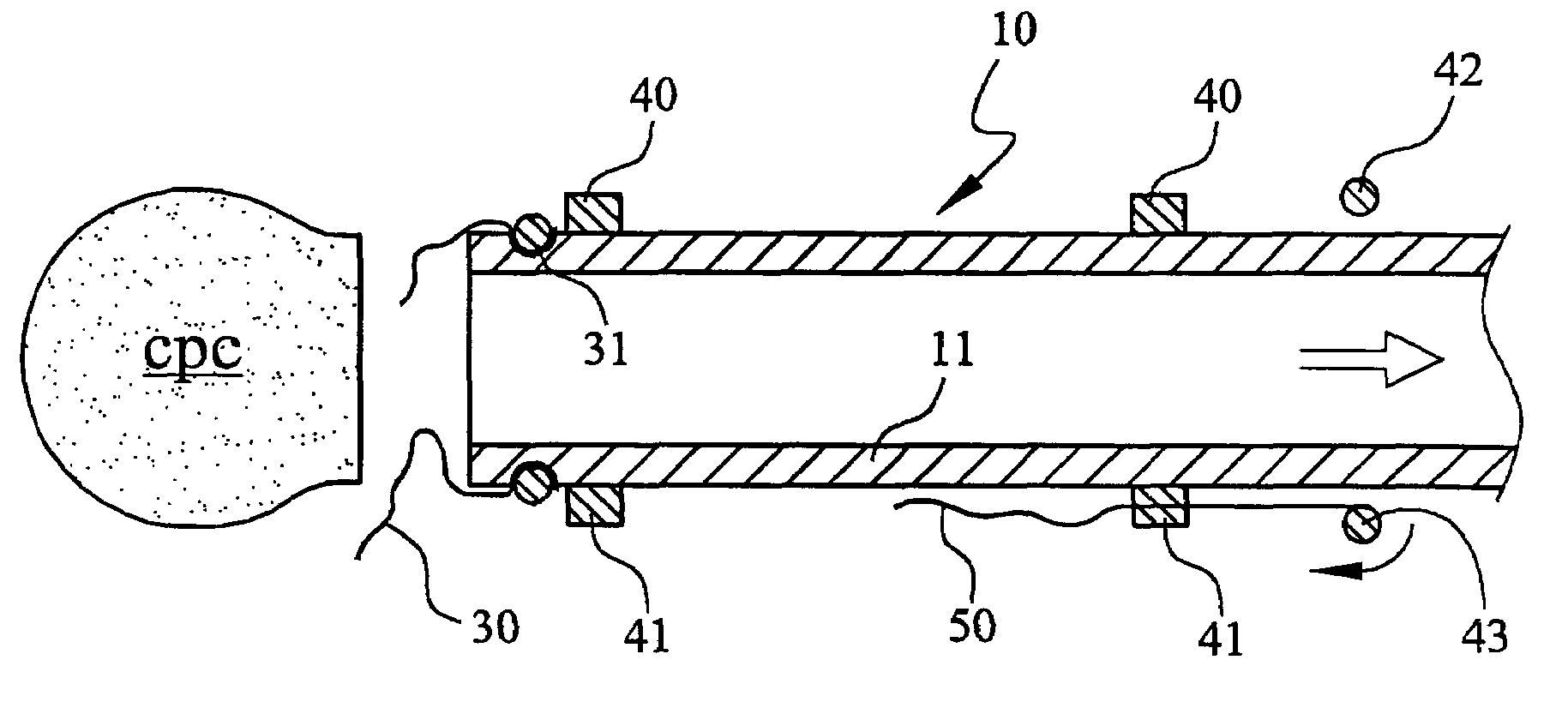 Method for forming a hardened cement in a bone cavity