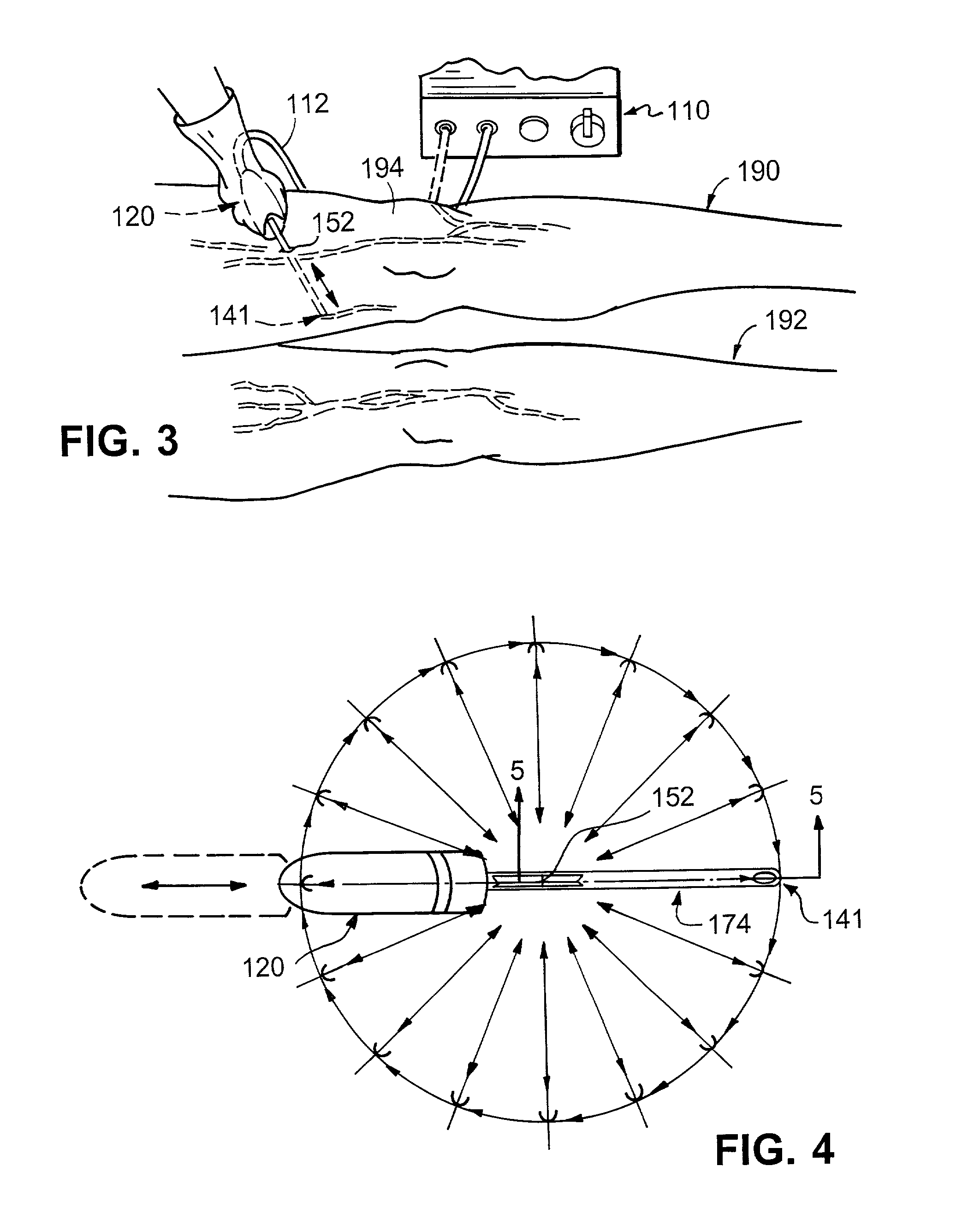 Methods and apparatus for removing veins