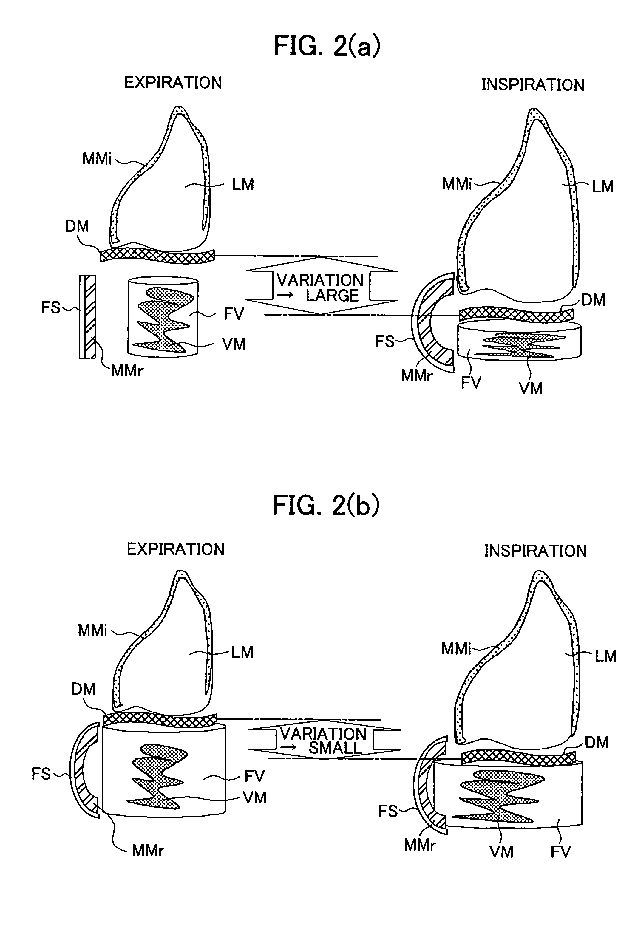 Apparatus for assuming information on the amount accumulated visceral fat of a human body