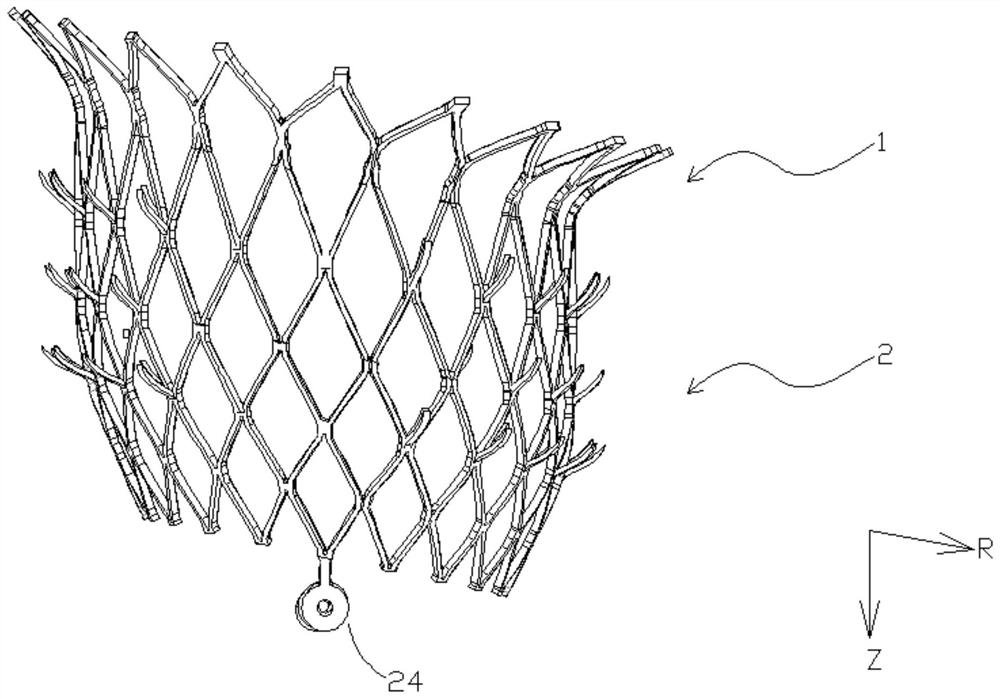 A transcatheter mitral valve stent