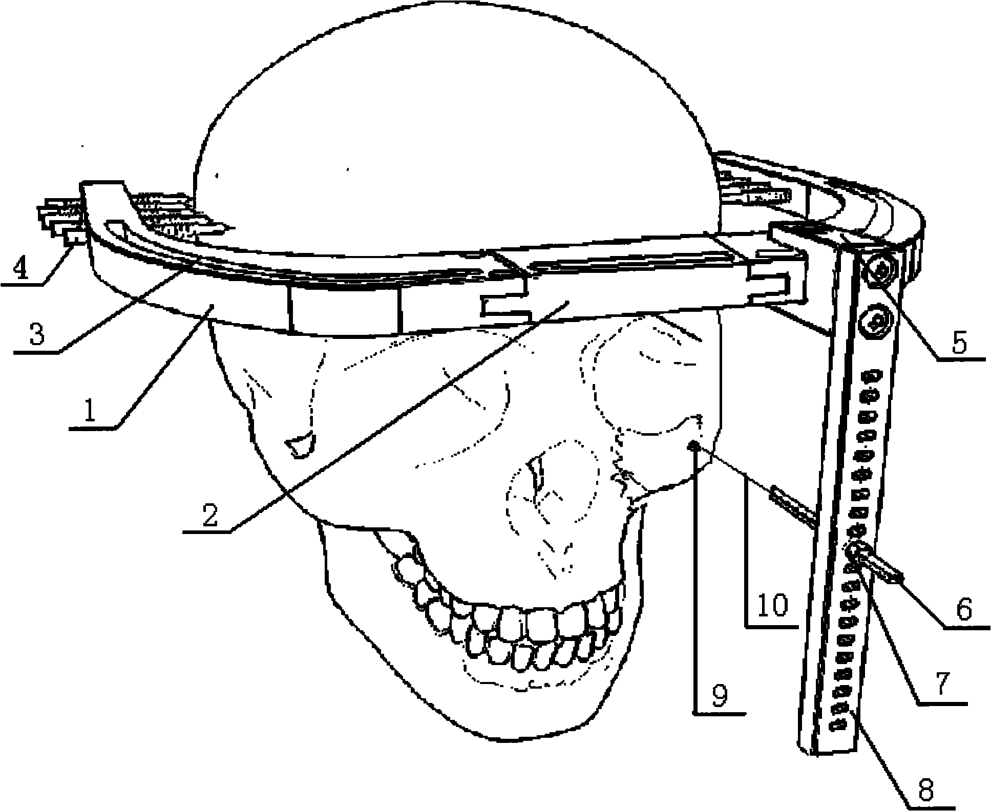 Adjustable mid-face bone tractor and design method thereof