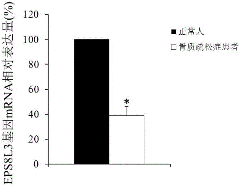 Application of EPS8L3 gene expression detecting reagents to preparing osteoporosis diagnostic products