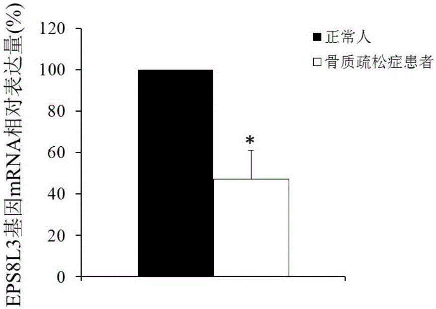 Application of EPS8L3 gene expression detecting reagents to preparing osteoporosis diagnostic products