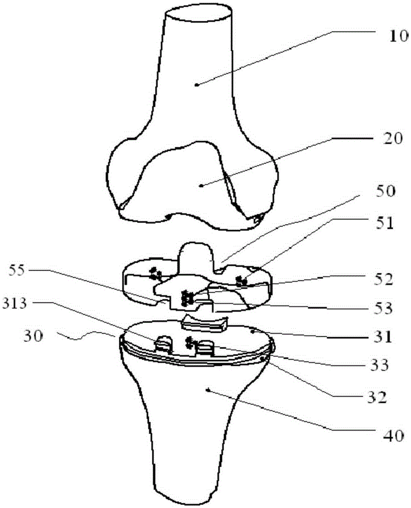 Knee joint prosthesis