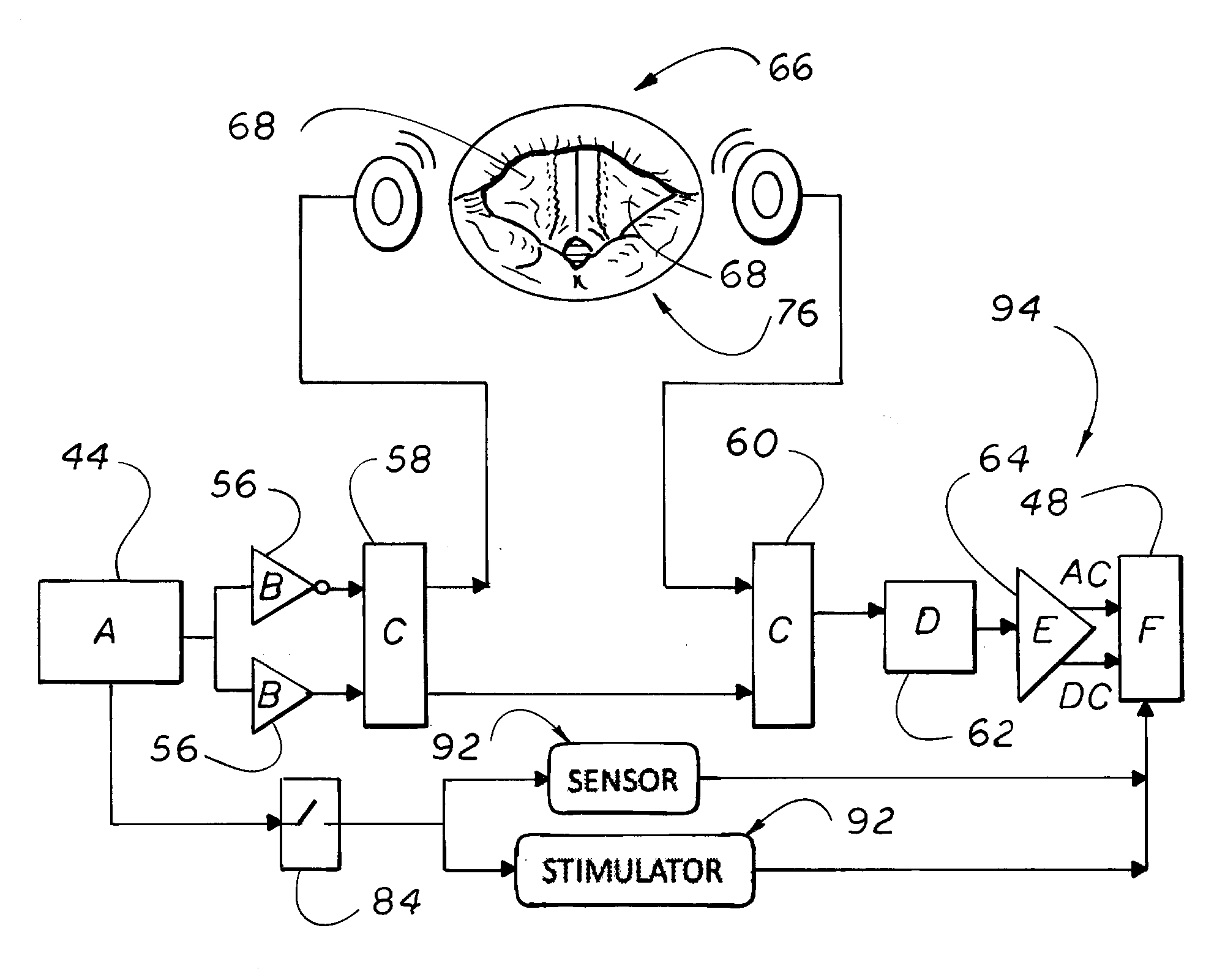 Methods and devices for diagnosing and treating vocal cord dysfunction