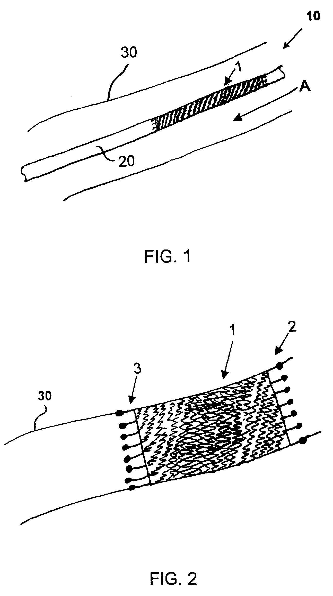 Stent and method for manufacturing the stent