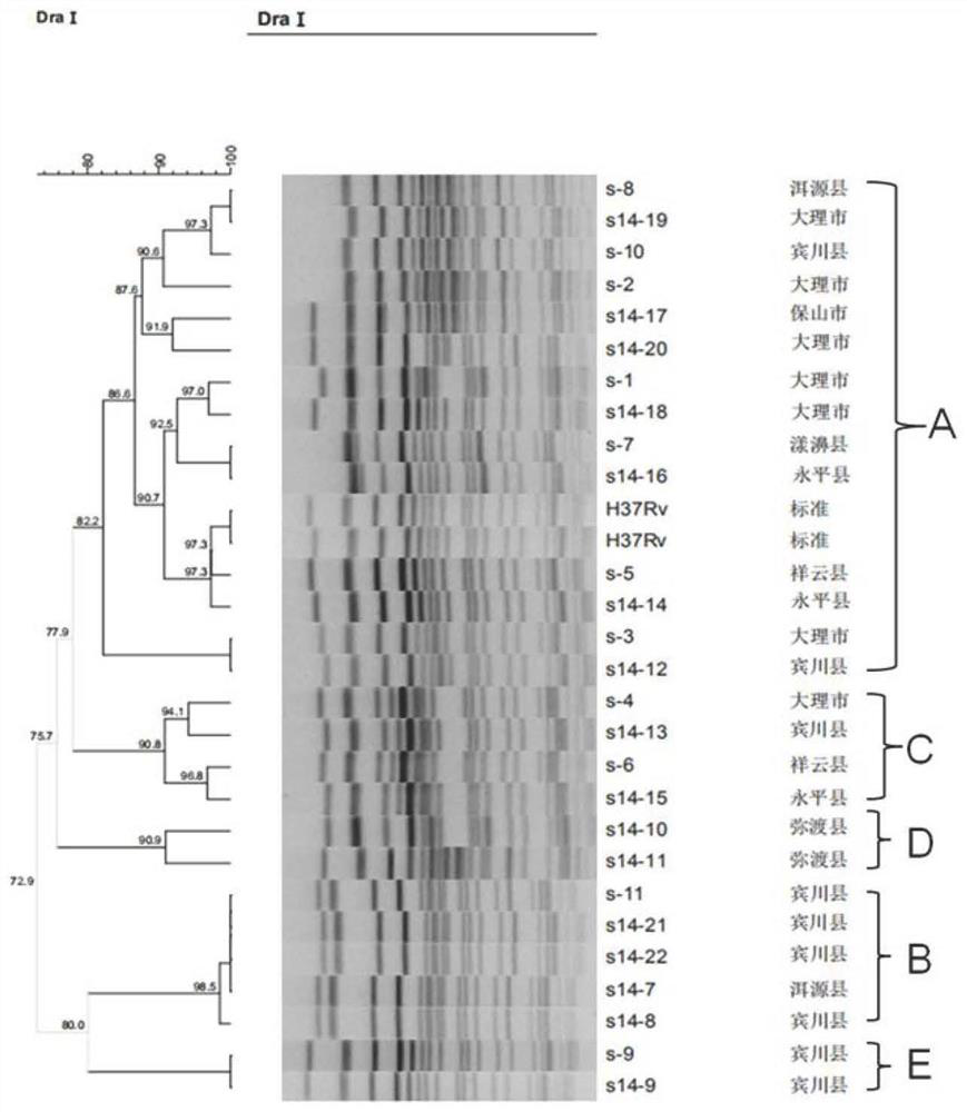 DNA extraction method in pulse field gel electrophoresis (PFGE) method parting of mycobacterium tuberculosis (M. tb)