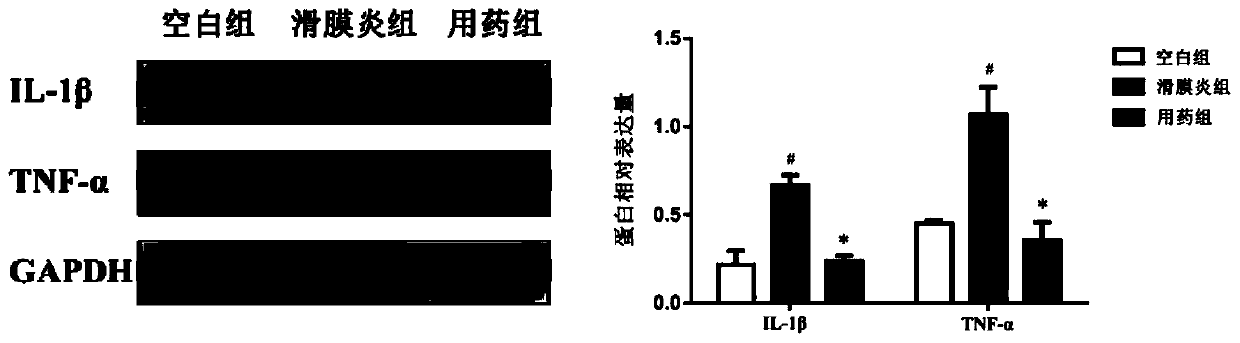 Traditional Chinese medicine composition for treating gonarthromeningitis and preparation method thereof