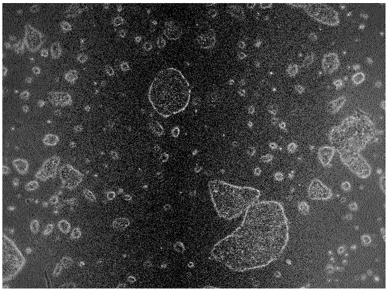 Culture medium for pluripotent stem cells