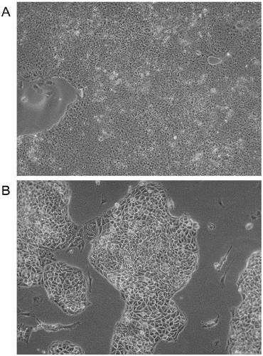 Culture medium for pluripotent stem cells