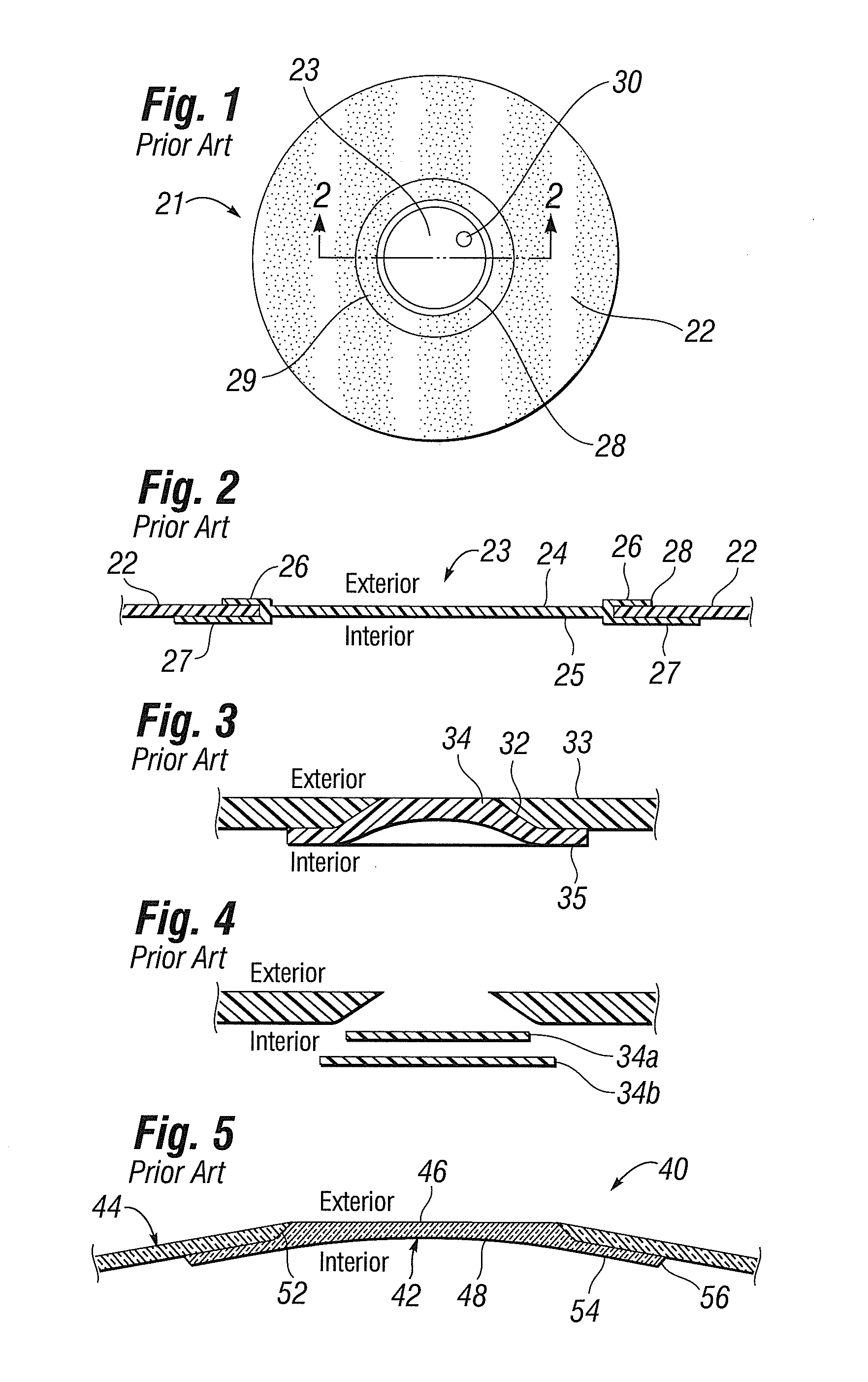 Flush patch for elastomeric implant shell