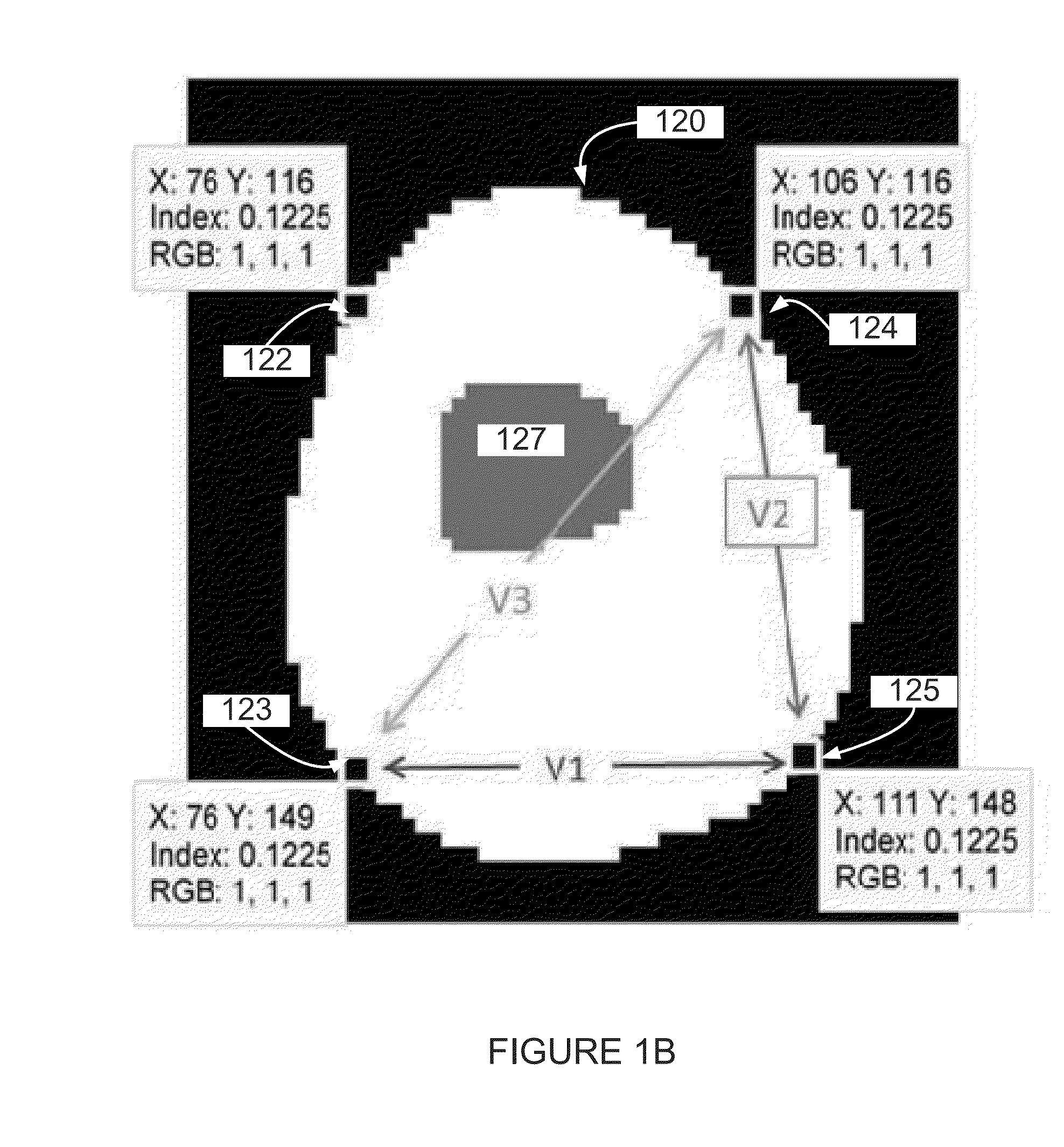 Diagnostic and monitoring electrical impedance tomography (EIT) system for osteoporosis