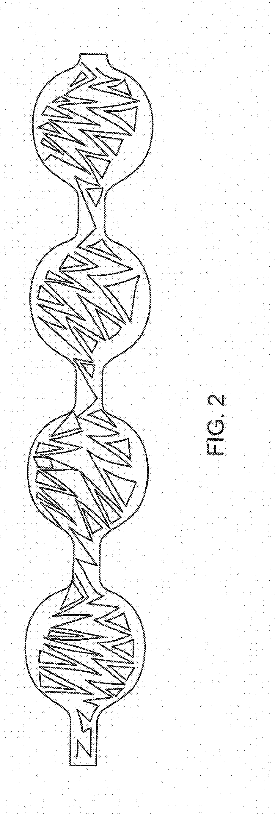 Intrasacular occlusion devices methods processes and systems