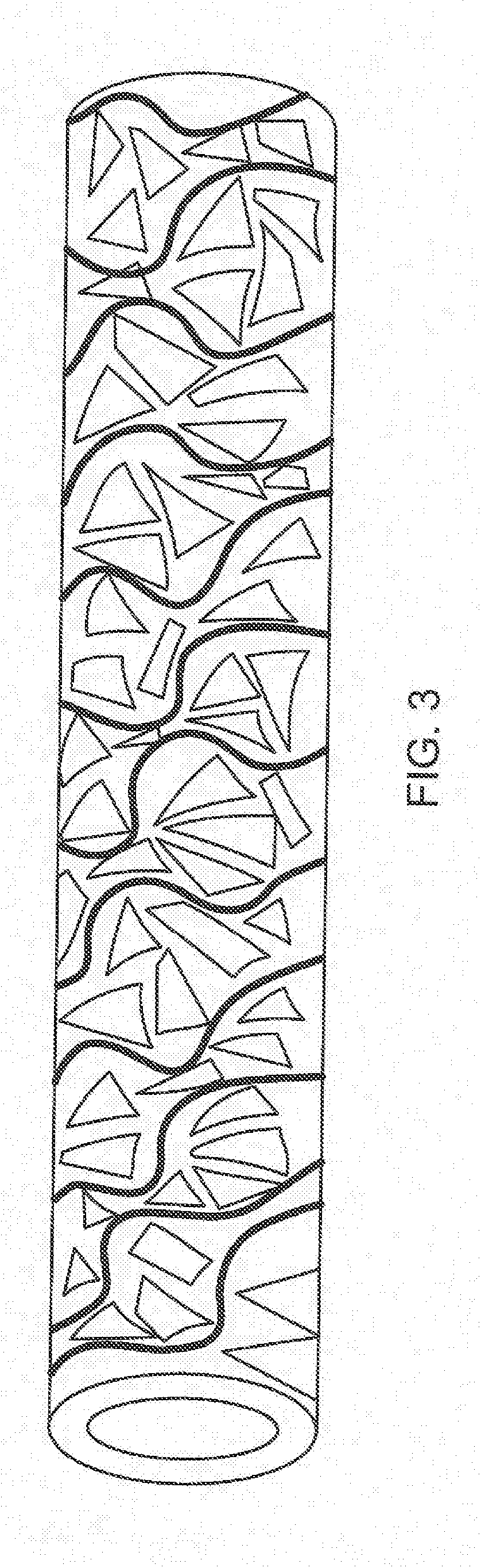 Intrasacular occlusion devices methods processes and systems