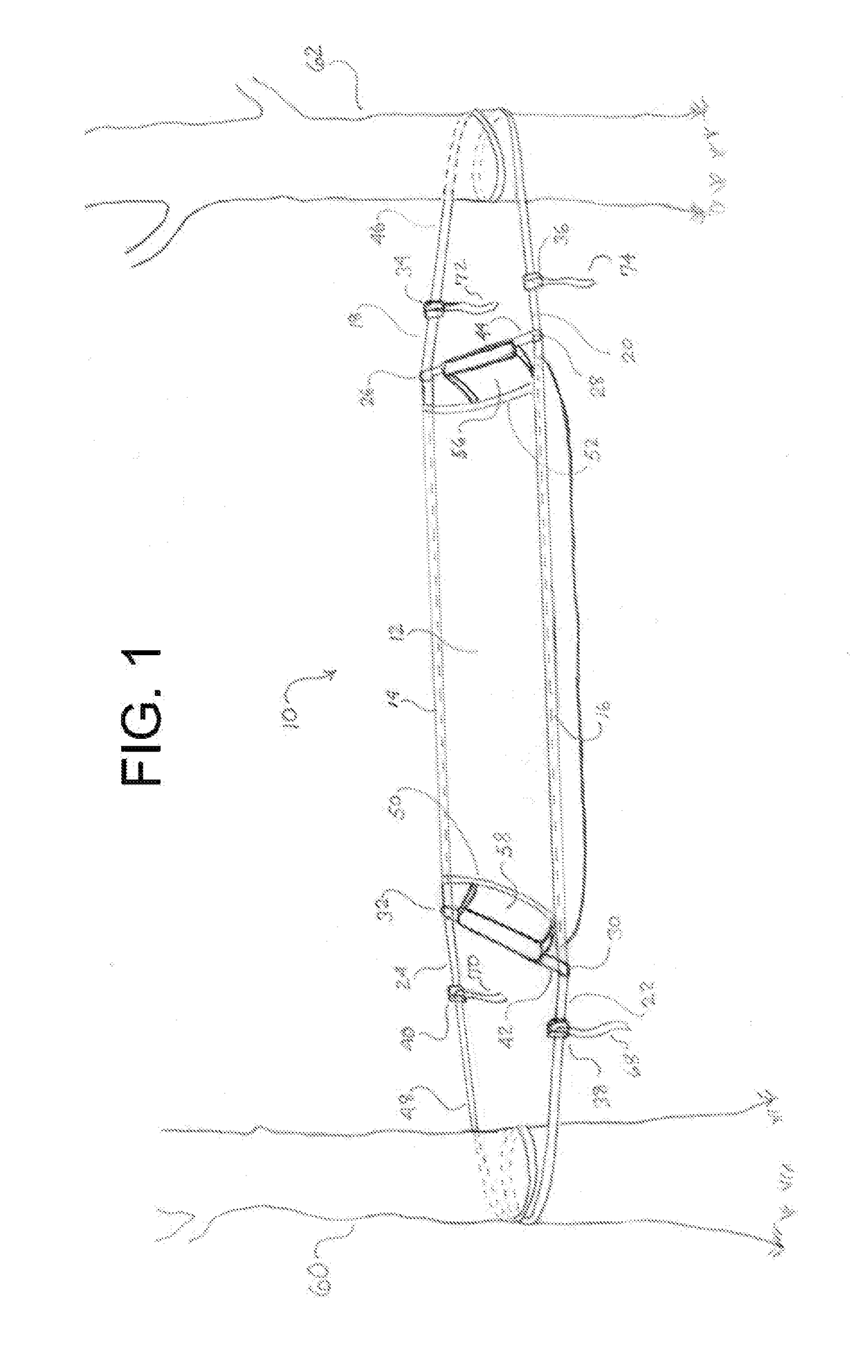 Independent hammock suspension system