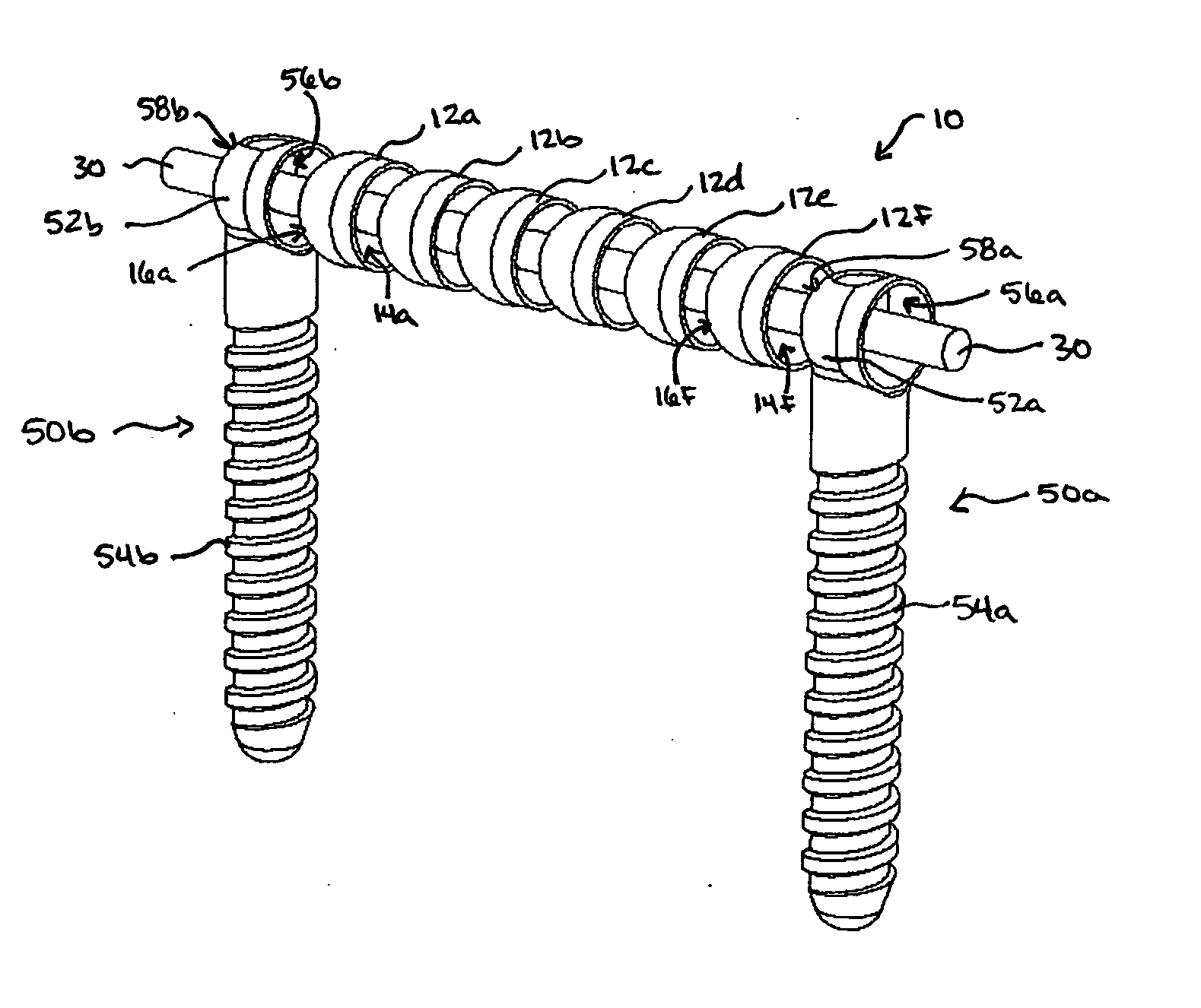 Flexible spinal fixation elements