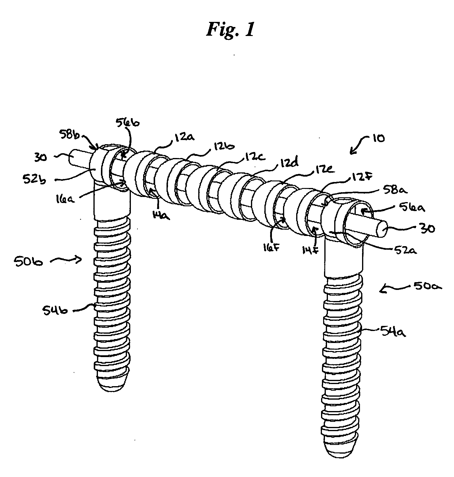 Flexible spinal fixation elements