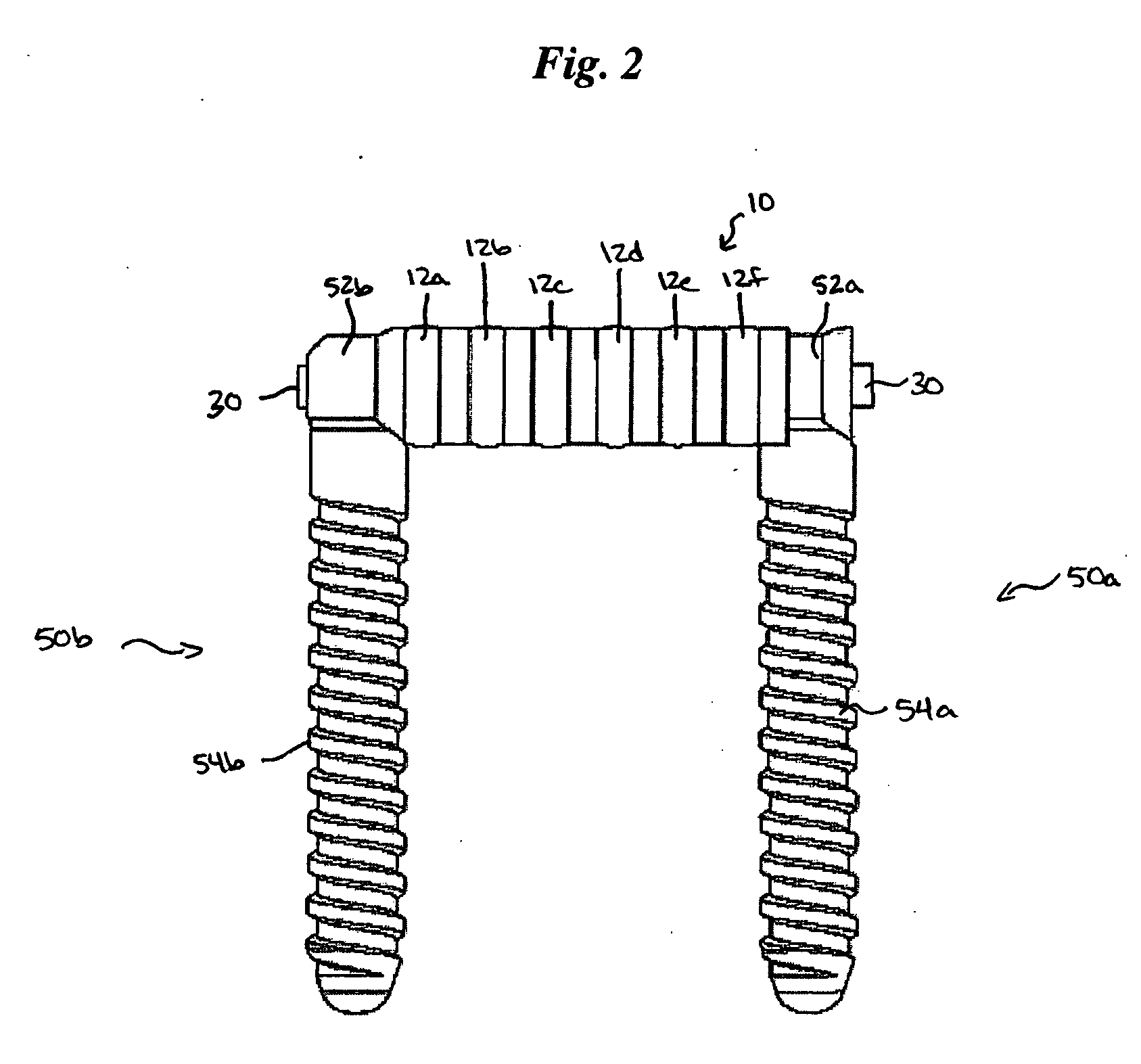 Flexible spinal fixation elements