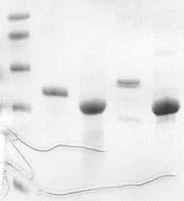 Mumps virus hn antigen and its use in detecting anti-mumps virus antibodies