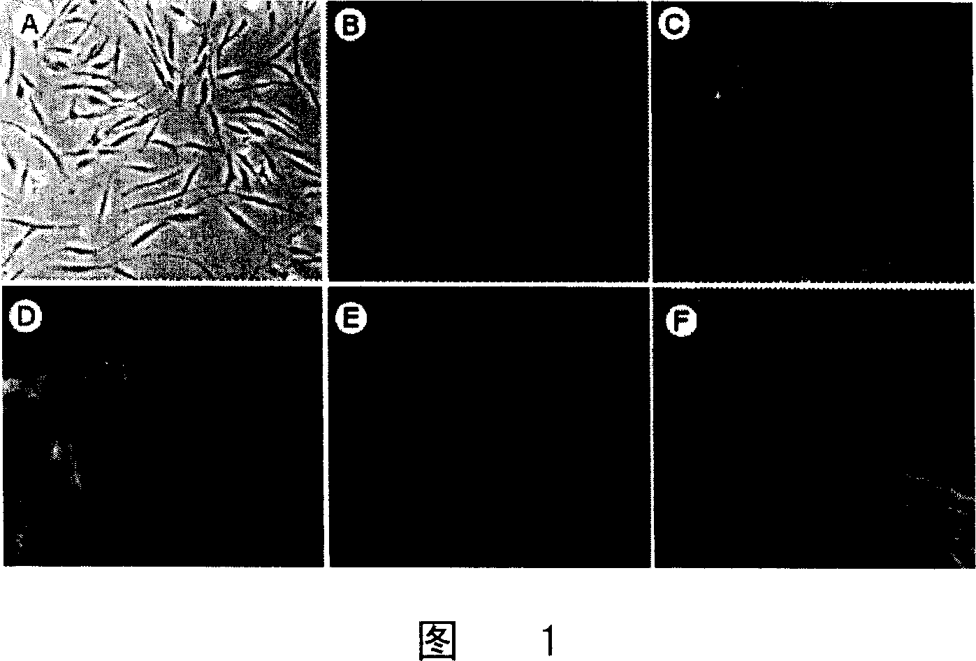 Culture and use for dermis fibroblast