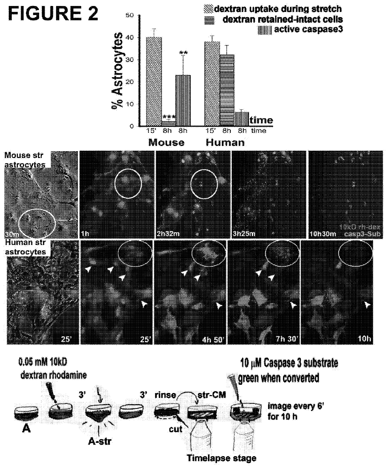 Astrocyte traumatome and neurotrauma biomarkers