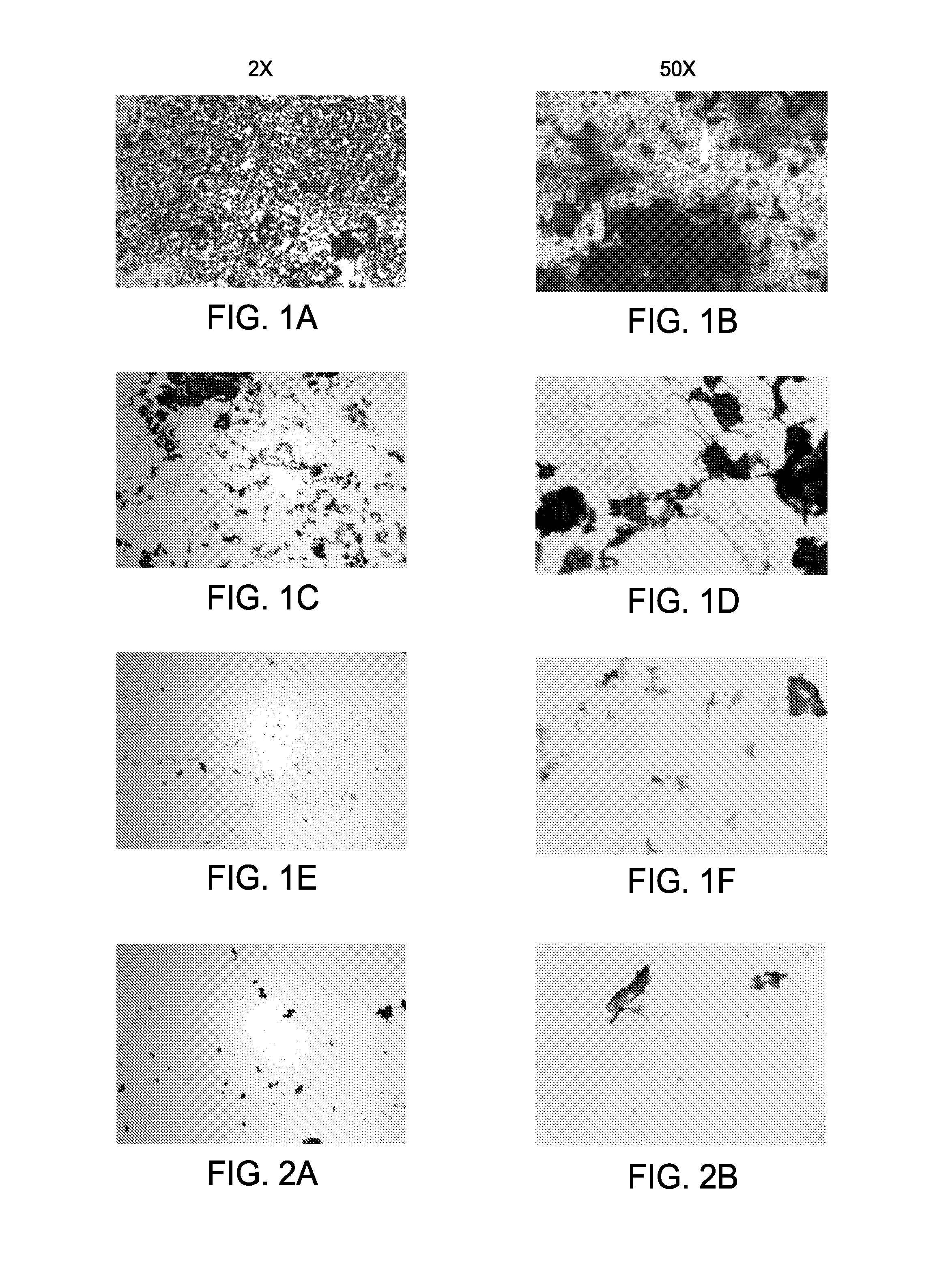 Compositions and methods for treating mycobacterial infections