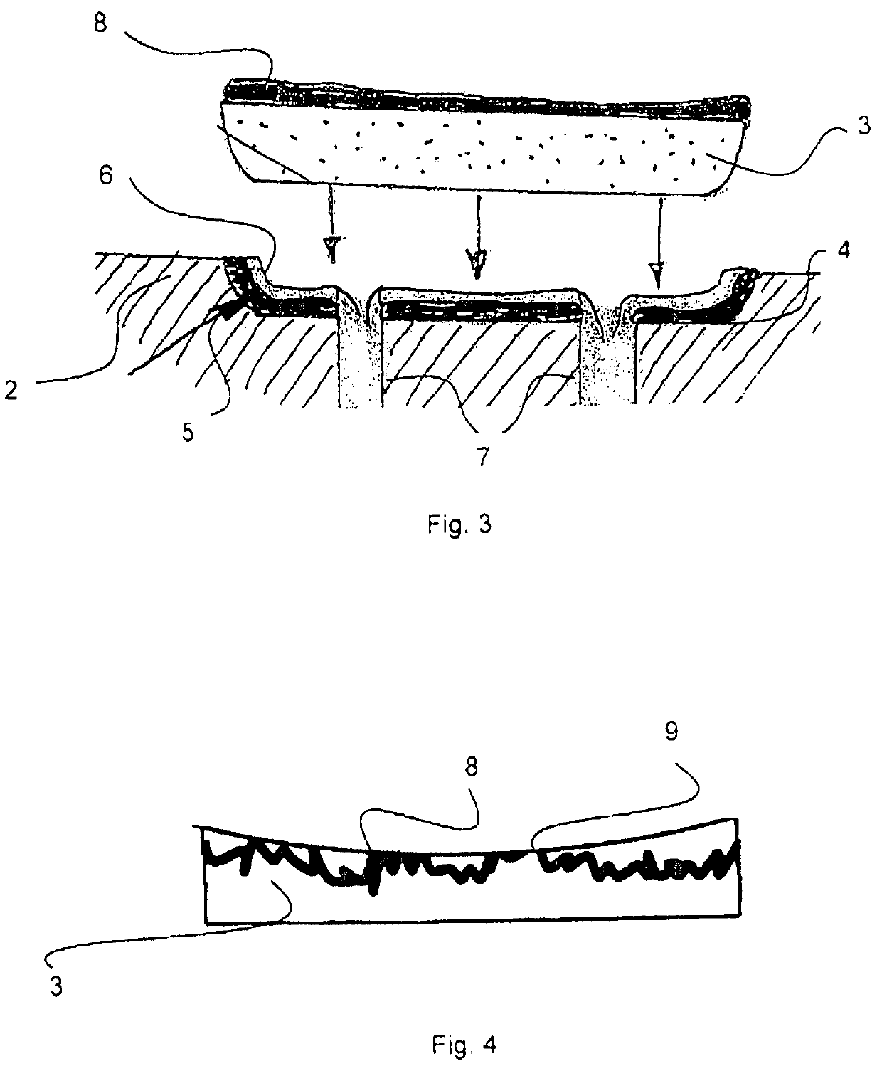 Orthopedic implant