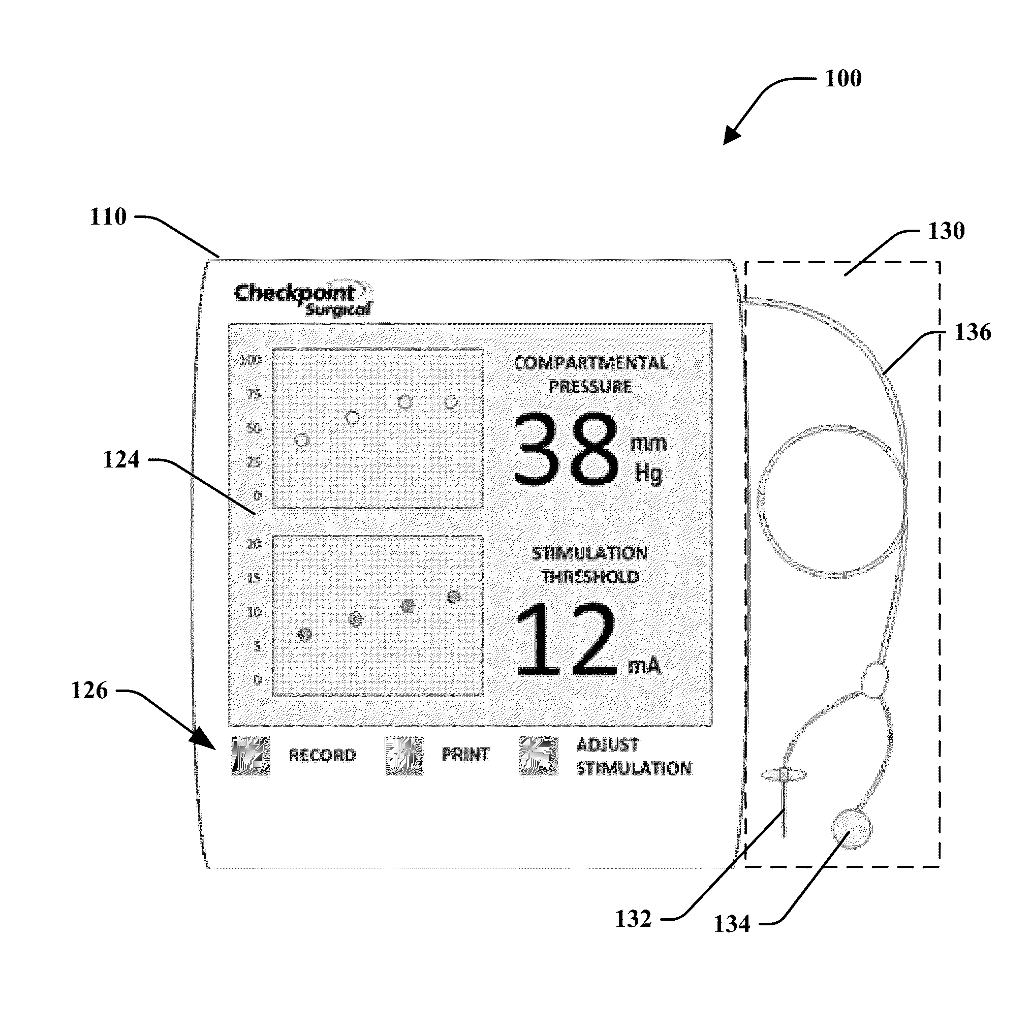 Percutaneous stimulation device and method for detecting compartment syndrome